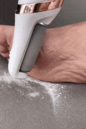 Electric Pedicure Callus Remover