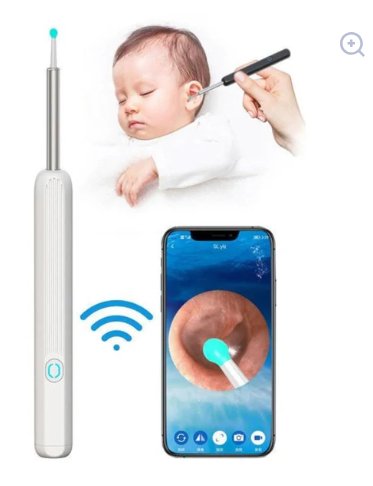 Earwax Removal Kit with HD Camera
