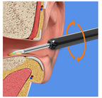 Earwax Removal Kit with HD Camera