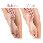 Electric Pedicure Callus Remover
