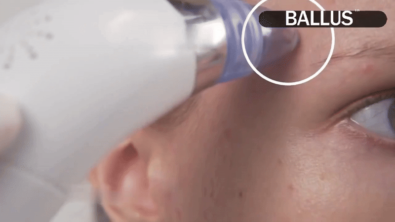 Visible Pore Cleaning Device